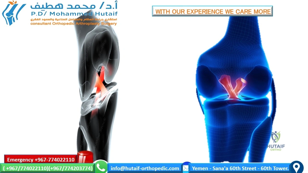 The best excellent orthopedic doctor The best excellent arthroplasty doctor