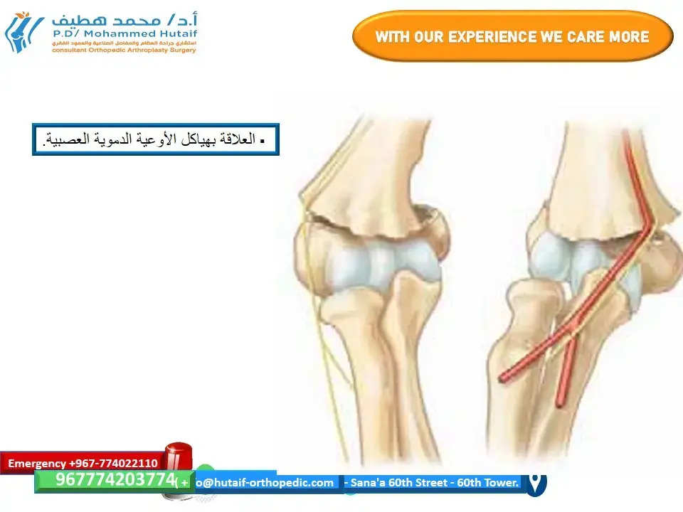 حلول متقدمة لـ بابروسكي من النوع: استعادة الورك وفقدان العظم