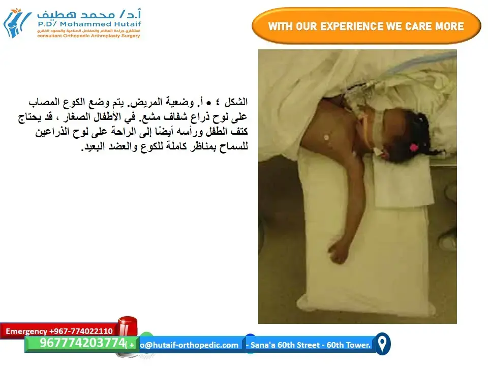 اكتشف: كسر مونتيجيا.. دليل النجاة لامتحان FRCS!