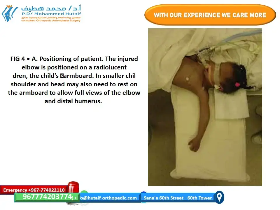 اكتشف عالم العظام: دليل الخصائص النسيجية