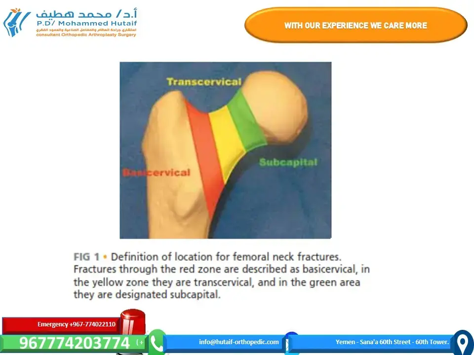 اكتشف: كسور العظام المرضية.. دليل شامل للوقاية والعلاج!