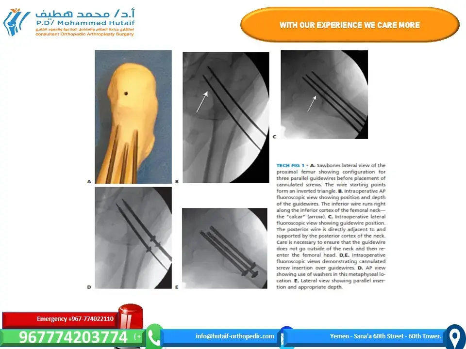 التشريح الجراحي لمفاصل الخلفي من القدم: دليل د. محمد هطيف