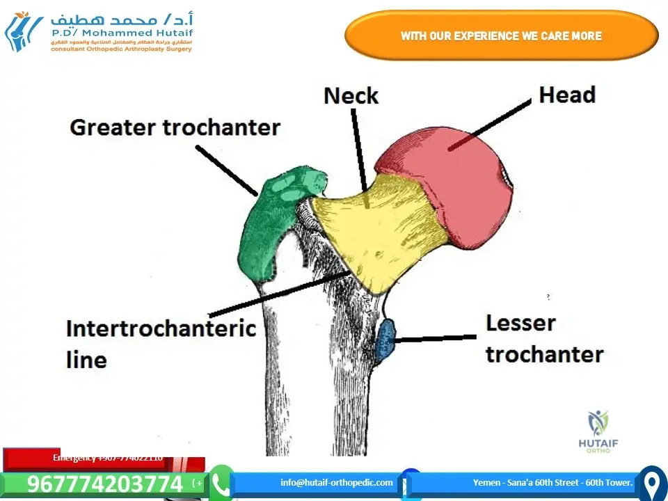 Femoral Neck Fractures: Advanced Guide to Pathophysiology, Diagnosis & Evidence-Based Management