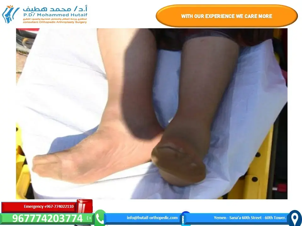 اكتشف: آلام المفاصل.. دليلك الشامل لعلاج التهاب المفاصل!