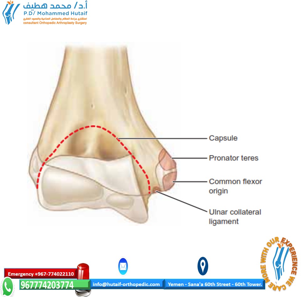 Illustration of medial epi condyle - Dr. Mohammed Hutaif