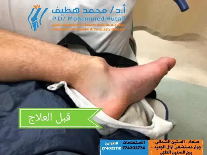 دليلك الشامل لعلاج مشاكل الطرف العلوي: حلول فعّالة