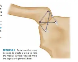 اكتشف: علاج إصبع جيرسي - دليل الفحص الشفوي FRCS