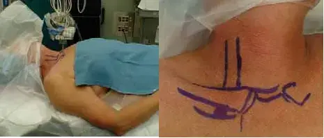 لا تتجاهلها: كل ما تحتاج معرفته عن أورام القدم والكاحل