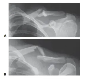 اختبر معلوماتك: أسئلة القدم والكاحل الطبية!