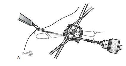 احمِ مفاصلك: دليلك الشامل لغضروف قوي وصحة مثالية