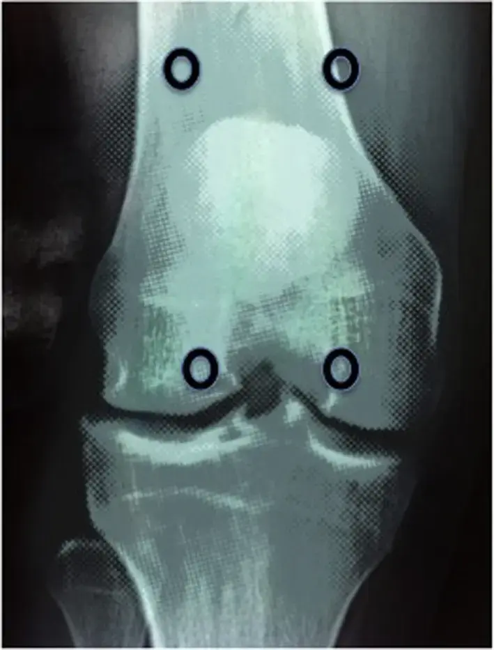 اكتشف مركز هطيف للعظام: رائد الرعاية العظمية في اليمن!