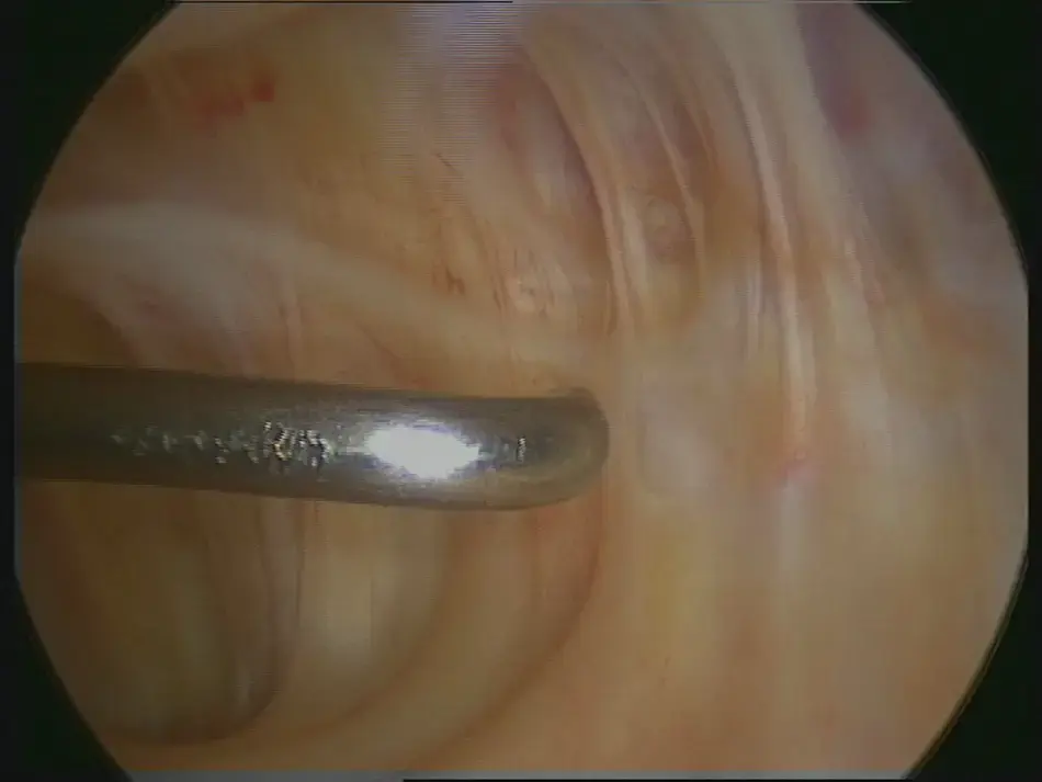 تخلص من آلام الركبة: فهم اسباب وعلاج فعال ودائم