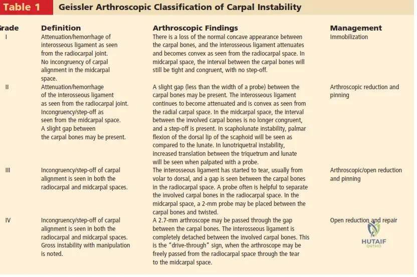 Table 1 Geissler Arthroscopic Classification of Carpal Instability Grade Definition Arthroscopic Findings Management I Attenuation/hemorrhage of There is a loss of the normal concave appearance between Immobilization interosseous ligament as seen the carpal bones, and the interosseous ligament attenuates from the radiocarpal joint. and becomes convex as seen from the radiocarpal space. In No incongruency of carpal midcarpal space, the interval between the carpal bones will alignment in the midcarpal still be tight and congruent, with no step-off. space. II Attenuation/hemorrhage A slight gap \(less than the width of a probe\) between the Arthroscopic reduction and of the int