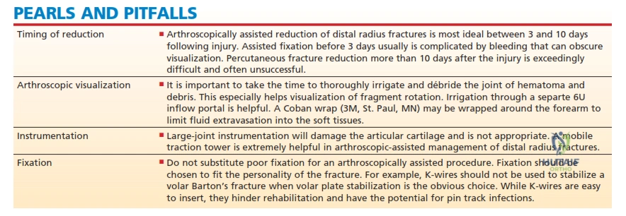 G 5 • In this case,  following reduction to the distal radius  fracture, the articular disc was  palpated and found to be lax but with no  peripheral tear. The  large ulnar styloid fragment was   reduced  with a  micro   Acutrak  screw   \(Acumed, Hillsboro, OR\).
