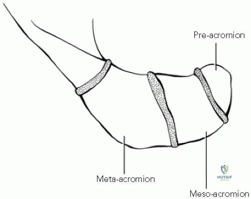 كيفية علاج التهاب غمد الأوتار Quervain Tenosynovitis بسهولة وفعالية"