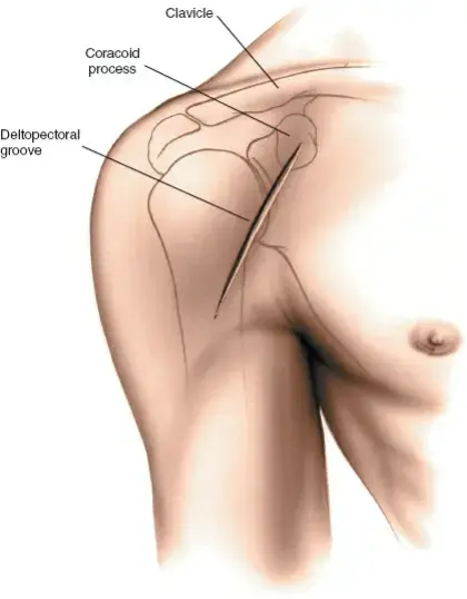 استعد عافيتك: دليلك الأمثل للرعاية بعد العمليات