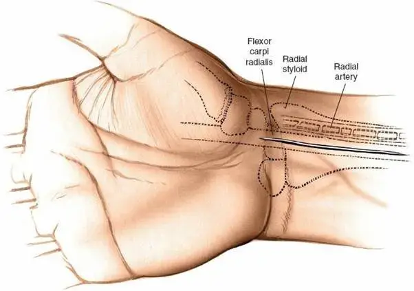 اكتشف: علاج كسر الحدبة الكبيرة.. عظام أقوى!