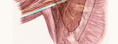 صورة توضيحية لـ استكشاف واستئصال أورام الإبط المعقدة: دليل شامل للمرضى