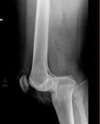 اكتشف: فحص الزمالة (جراحة العظام) - عرض حالة لدغة قتالية!