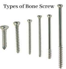 Master All Types of Screws in Orthopedics: FRCS Exam Guide