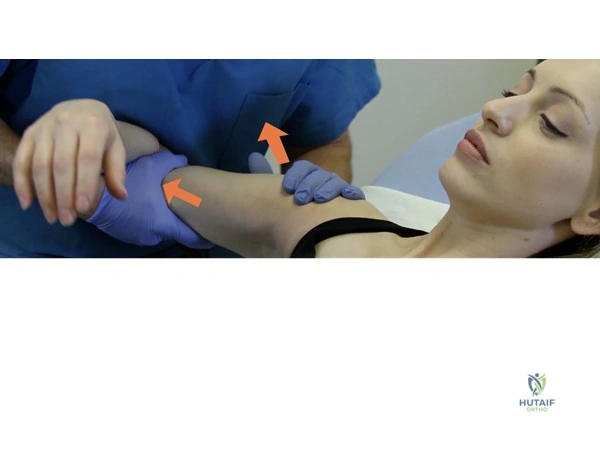 Superior Glenohumeral Dislocation