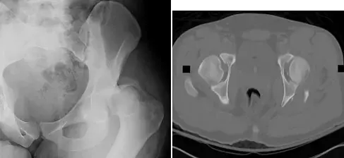 اكتشف حلول هشتايف للعظام: رعاية شاملة ومتقدمة!