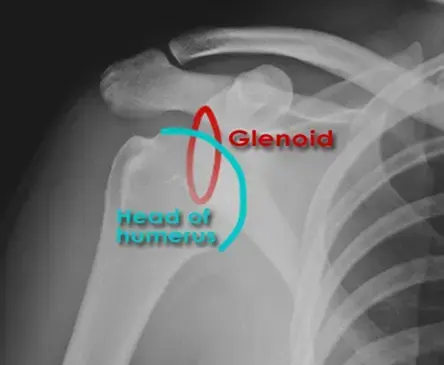 اكتشف: البيولوجيا الخلوية للعظام.. أسرار صحة هيكلك!