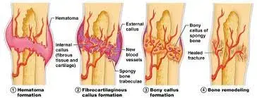 دليلك الشامل لآلام الكاحل: أسباب وعلاج فعال