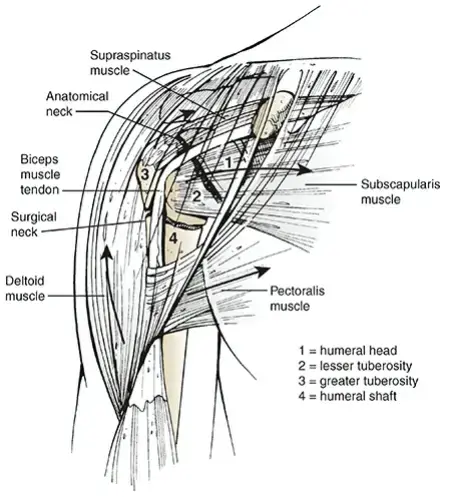 دعامات مفصل الورك الإسمنتية المصقولة لتثبيت متين يدوم طويلا