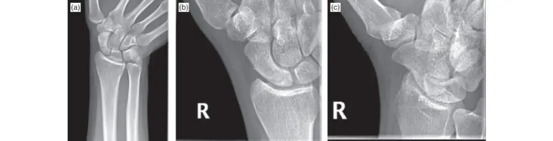 أبحاث الدكتور محمد هطيف NIH