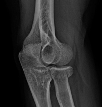 Illustration 31 for Solve Shoulder & Elbow Cases: When a Patient Presents to Clinic