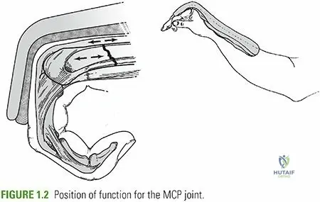 Illustration of closed reduction casting - Dr. Mohammed Hutaif