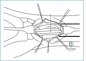Illustration of must be taken - Dr. Mohammed Hutaif