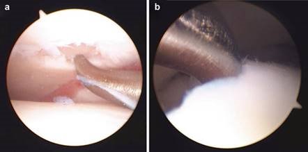 Illustration 31 for First Metatarsal Surgery: Expert Solutions for Foot & Ankle Pain