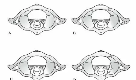 كسور الفقرة الأطلسية (C1): دليل شامل للمرضى نحو الشفاء والتعافي مع الأستاذ الدكتور محمد هطيف