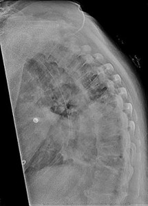 Orthopedic Spine MCQs: Don't just pmid view abstract, master the topic!