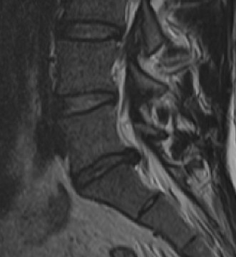 Illustration 5 for Master Orthopedic Spine Cases: Sharpen Your Diagnostic Skills