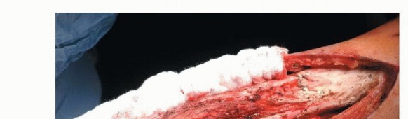 وصف طبي دقيق للمريض