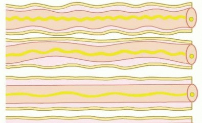 Surgical Treatment of Nerve Injuries in Continuity