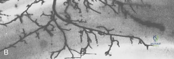 Illustration of tendon tendon tendon - Dr. Mohammed Hutaif