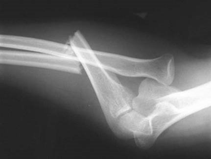 Illustration 16 for Ace Your FRCS: Key Questions in Trauma & Orthopaedics