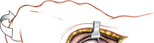 Illustration 198 for Essential Surgical Approaches: Uncover Every Aspect of the Wrist