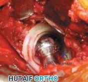 Clinical Image