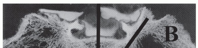 Illustration of toward the aiis - Dr. Mohammed Hutaif