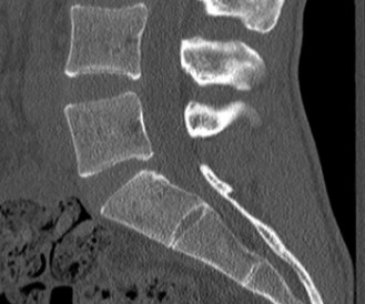 Illustration 8 for Spine Cases: Consider the Patient for Accurate Diagnosis