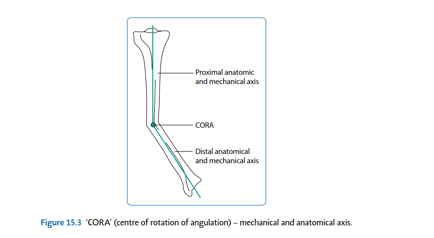 Illustration 3 for Limb Reconstruction: Restoring Function for Challenges Near and Far