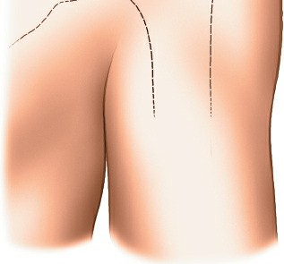 Illustration 216 for Essential Guide: Mastering Every Approach to the Shoulder