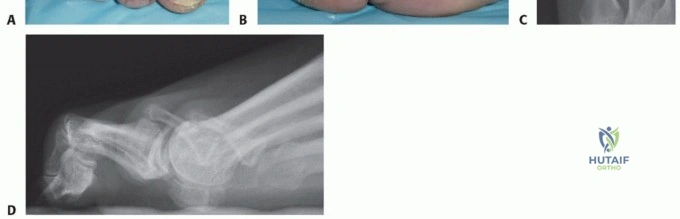 6 TO 9  Sports Medicine CASES