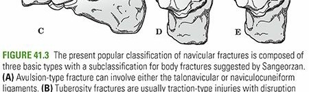 Illustration 12 for Mastering First MTP Joint & Forefoot Fractures: A Comprehensive Guide