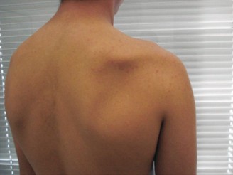 Illustration 11 for Solve Shoulder & Elbow Cases: When a Patient Presents to Clinic